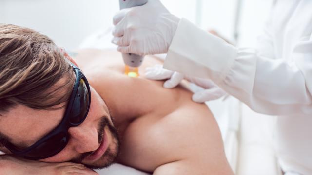 Mann bekommt Haarentfernung mit Laser auf Rücken