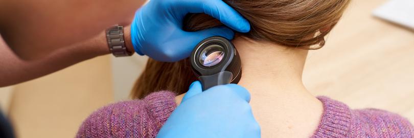 Ein Arzt untersucht bei einem Hautkrebs-Screening die Haut einer Frau mit einer Lupe