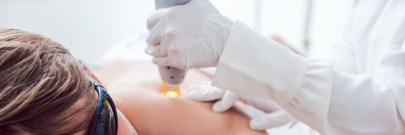 Mann bekommt Haarentfernung mit Laser auf Rücken