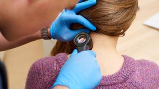 Ein Arzt untersucht bei einem Hautkrebs-Screening die Haut einer Frau mit einer Lupe